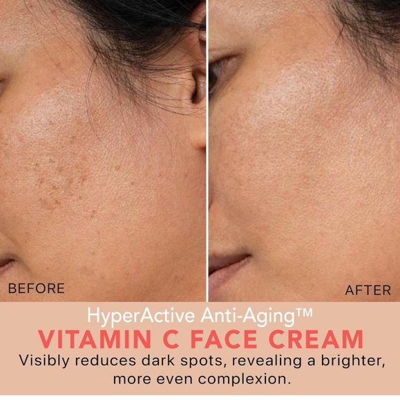 Anti Aging Vitamin C Face Cream - Picture 2 of 7